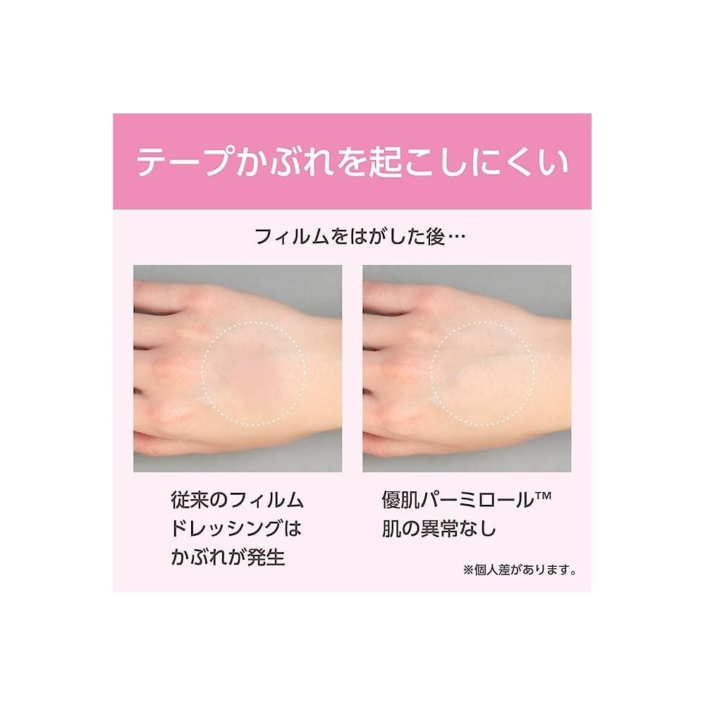 パーミロール 65-9142-71 優肌パーミロール 5cm×10m 14R05 【AXEL】 アズワン