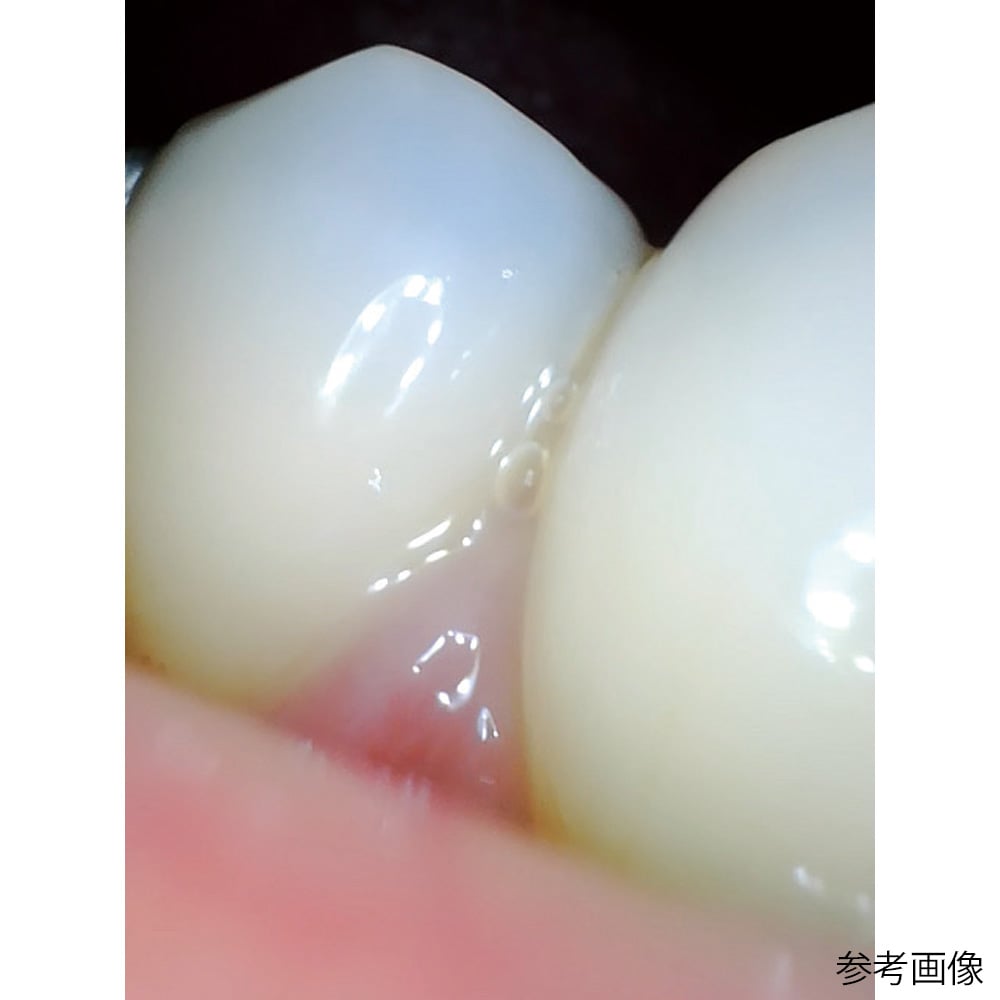66-0014-66 マイクロカメラ CU-0.5（口腔内撮影用カメラ）本体