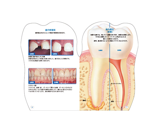 67-9219-13 型抜き絵本 歯 TP027 【AXEL】 アズワン