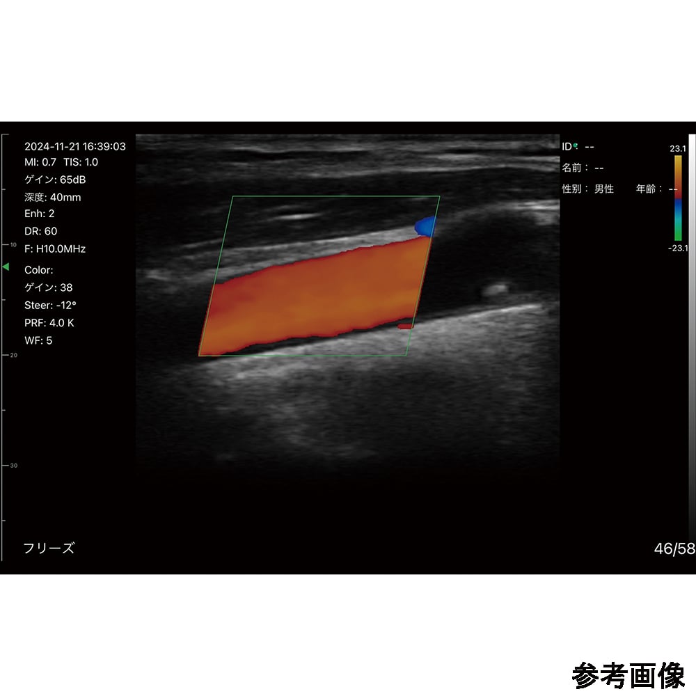 69-8862-30 汎用超音波画像診断装置 ポケットエコーmiruco CL5 589200