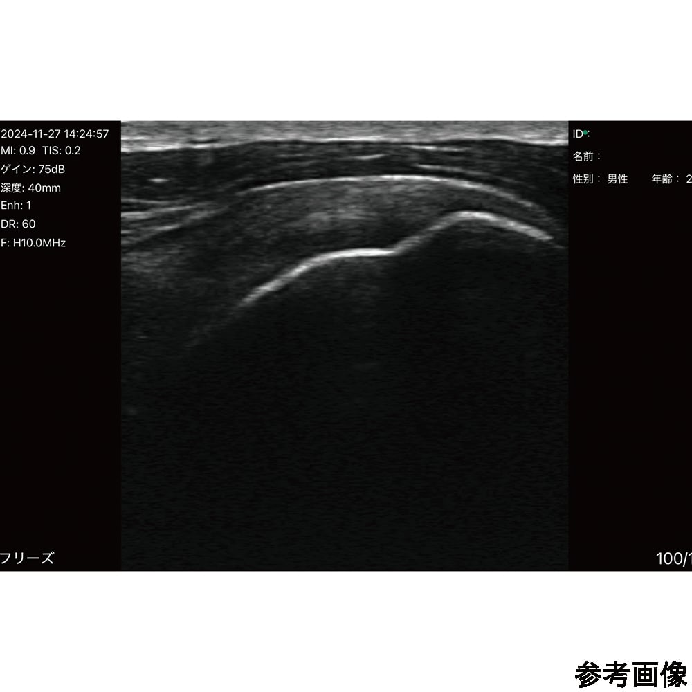 69-8862-30 汎用超音波画像診断装置 ポケットエコーmiruco CL5 589200
