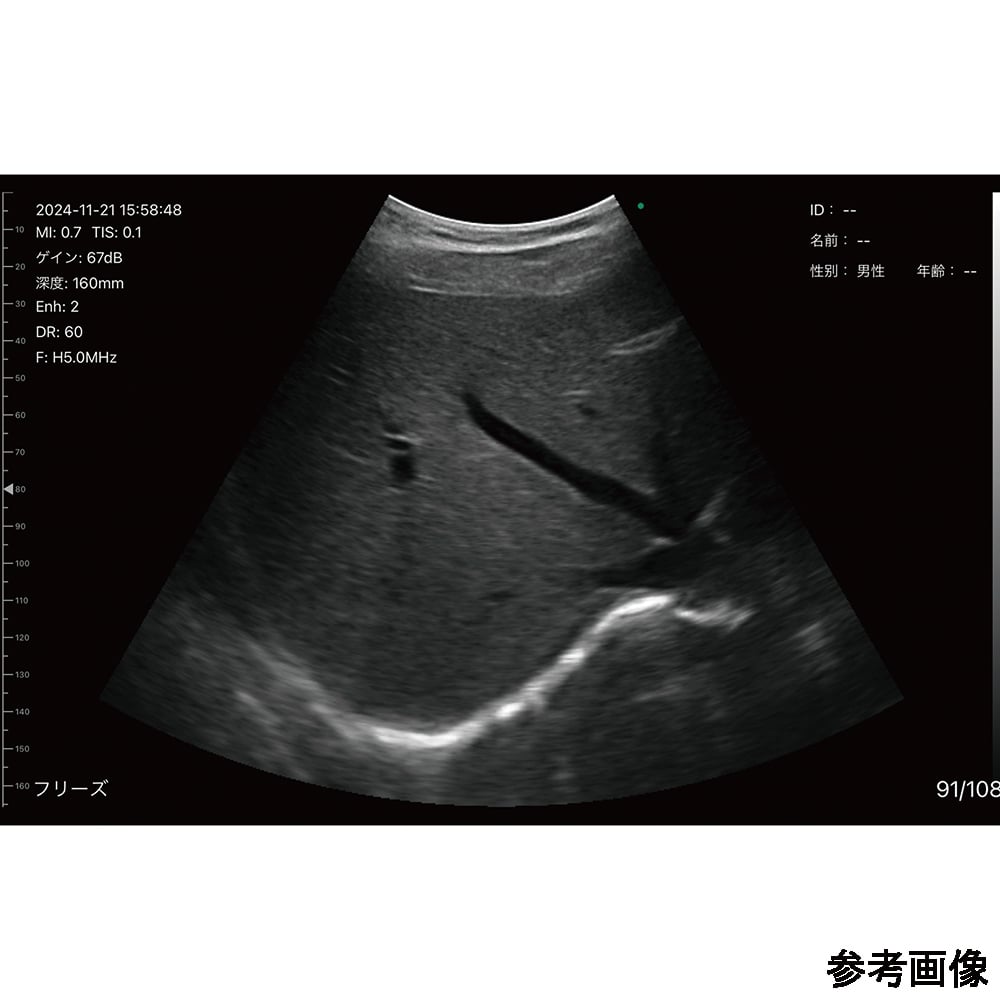 69-8862-30 汎用超音波画像診断装置 ポケットエコーmiruco CL5 589200