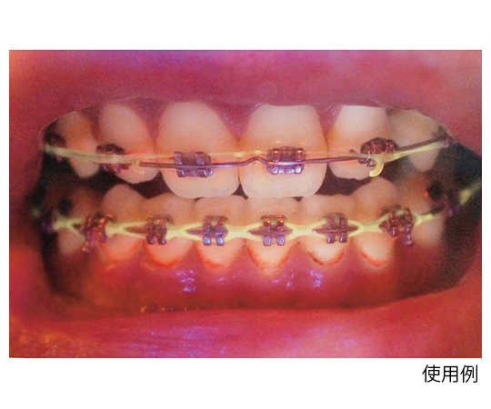 ファインデックス  口腔内観察用照明器 ファインデックス 口腔内観察用照明器