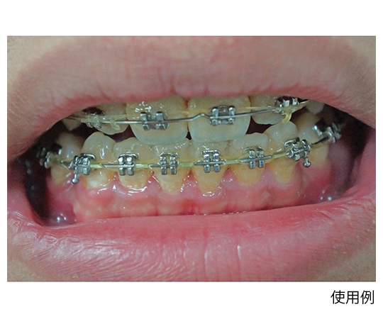 ファインデックス 口腔内観察用照明器