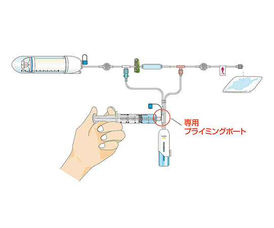 7-4691-11 シュアーフューザーA PCAセット 300mL (ボーラス3.0mL、持続3.0mL／h、ロックアウト30分) PCAS-3-30P/3030