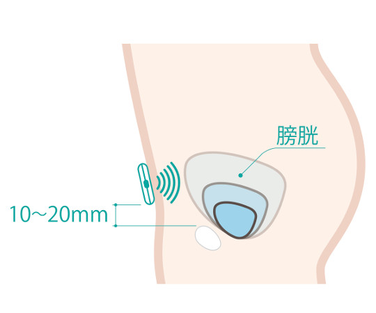 取扱を終了した商品です］DFree 排泄予測デバイス DFree-U1P 7-8264-01