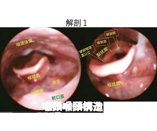 7-8305-01 嚥下治療講座 2018山形読影会DVD LPDV-02