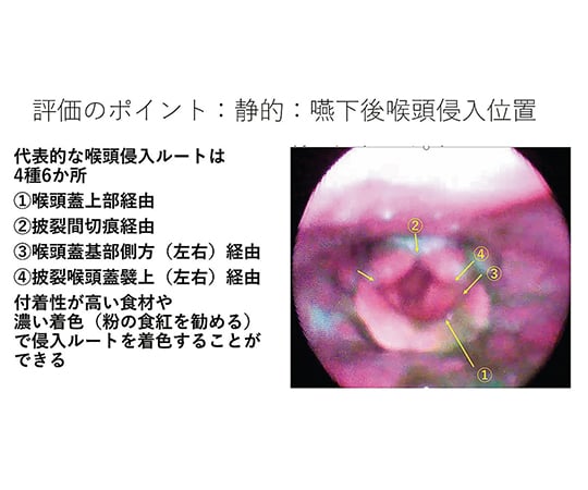 7-8305-01 嚥下治療講座 2018山形読影会DVD LPDV-02