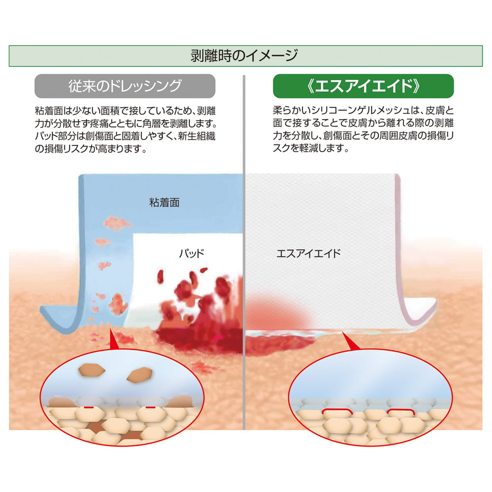 アルケア エスアイエイド 5号 50枚入 100×100mm EOG滅菌 18752