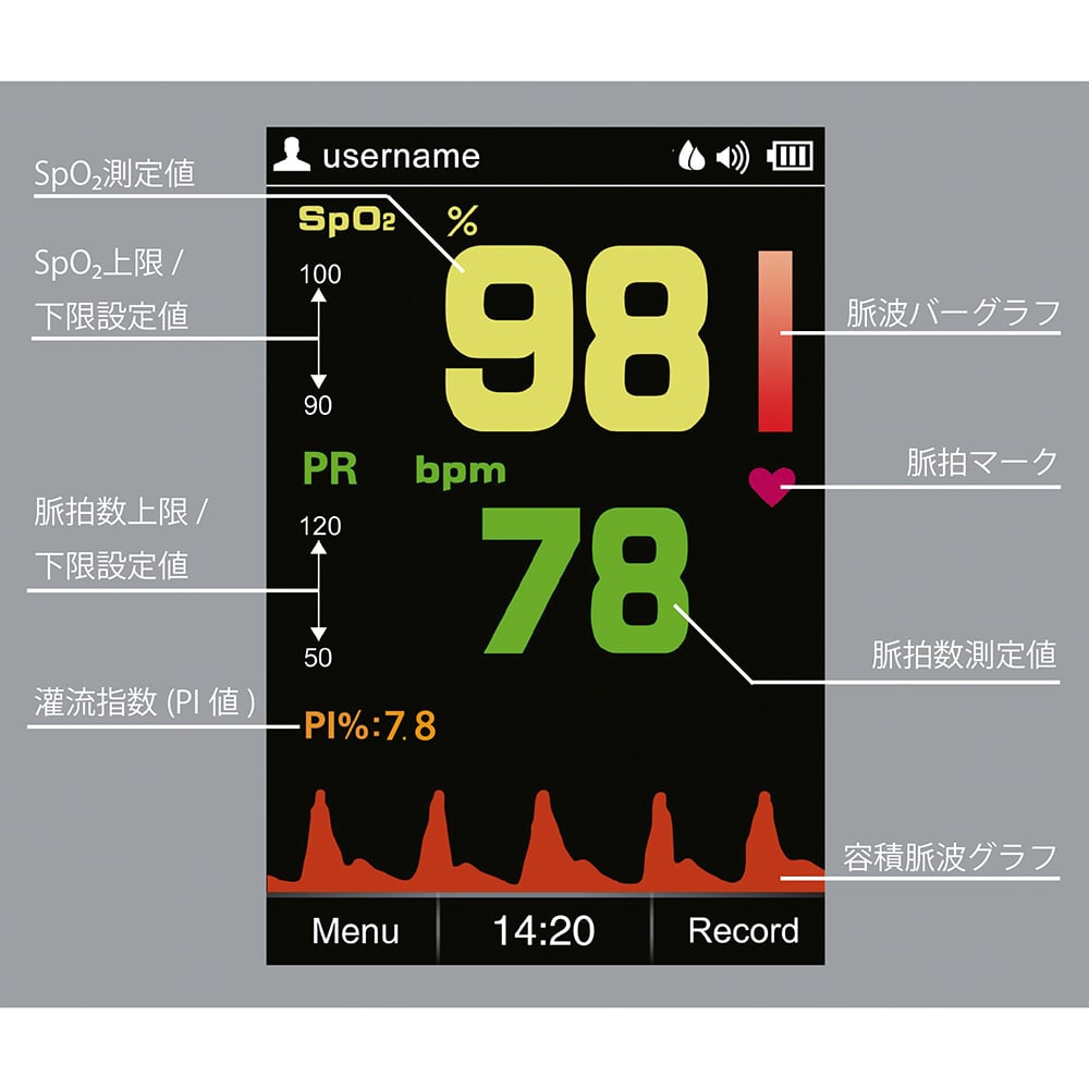 8-826-01 ナビス パルスオキシメータ（プローブタイプ）本体セット