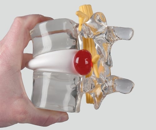 8-8422-01 ヘルニアモデル 190×160×140 4400 【AXEL】 アズワン