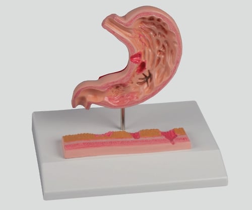 ナビス 8-8569-01　胃潰瘍モデル　１２０×９０×２０[個](as1-8-8569-01)