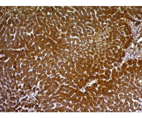 Glypican-3 （GPC3） （Hepatocellular Carcinoma Marker） 100ug　2719-MSM2-P1