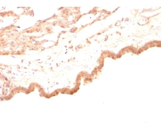 Glypican-3 （GPC3） （Hepatocellular Carcinoma Marker） 100ug　2719-MSM2-P1
