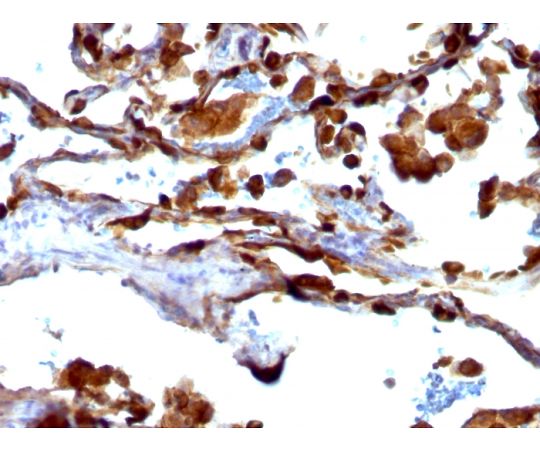 85-1231-05 MUC1 / CA15-3 / EMA / CD227 （Epithelial Marker） 20ug