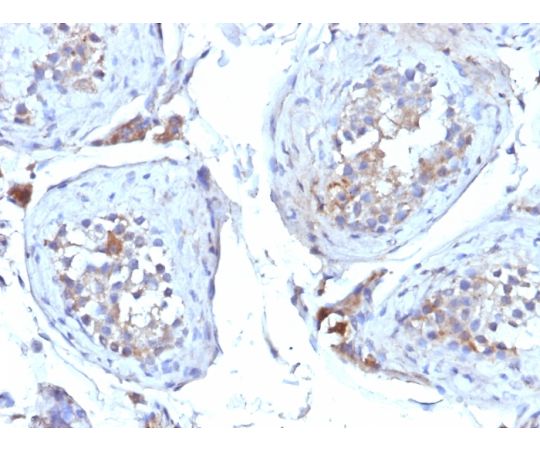 Sex Hormone Binding Globulin（shbg） 6462 Msmシリーズ Neobiotechnologies