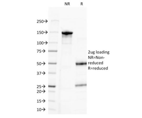 CD20/ MS4A1 (B-Cell Marker) 20ug