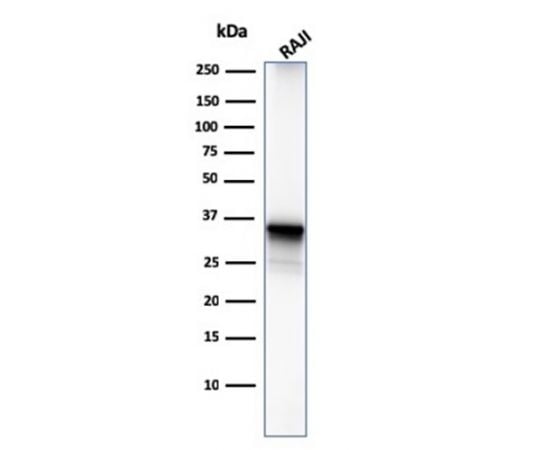 CD20/ MS4A1 (B-Cell Marker) 20ug
