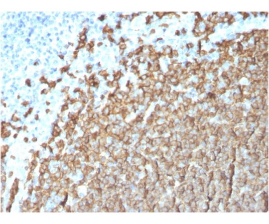 CD20/ MS4A1 (B-Cell Marker) 100ug