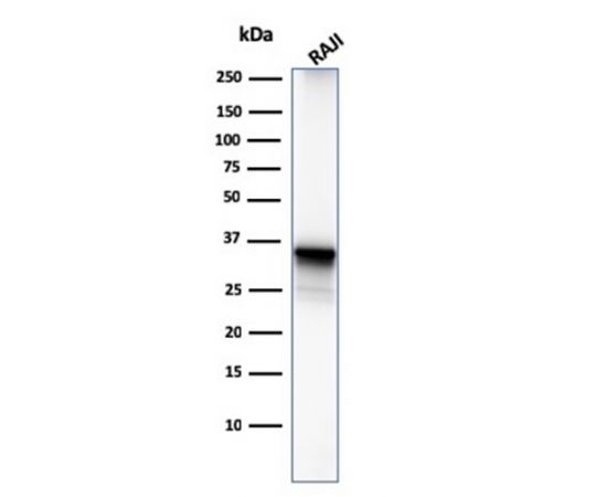 CD20/ MS4A1 (B-Cell Marker) 100ug