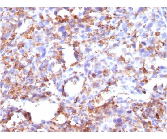 85-1240-86 CD68 （Macrophage Marker） 20ug 968-MSM5-P0 【AXEL