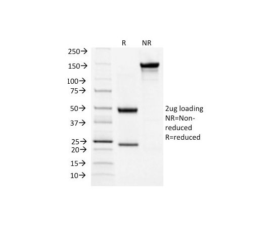 tsh receptor b chainthyroid marker 7253 msmシリーズ neobiotechnologies