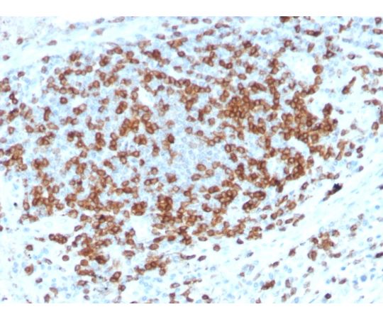 85-1291-73 CD3e (T-Cell Marker) 100ug 916-RBM17-P1 【AXEL】 アズワン