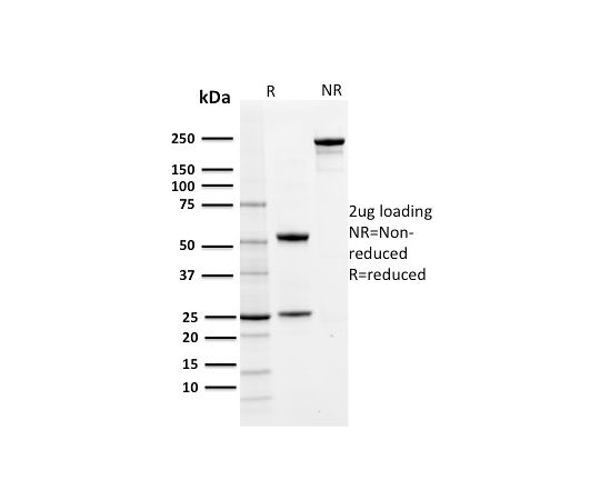 85-1300-03 PD-L1 / PDCD1LG1 / CD274 / B7-H1 (Cancer Immunotherapy ...