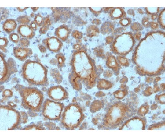 tpo-thyroid-peroxidase-thyroid-marker-7173-neobiotechnologies