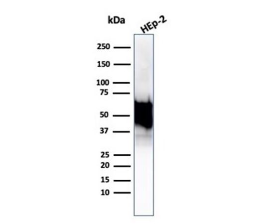 85 1318 09 Hsp60 （heat Shock Protein 60） （mitochondrial Marker） 100ug