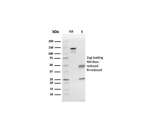 85-1326-60 CD74 （B-Cell Marker） （Transcription Regulator） 100ug 972 ...