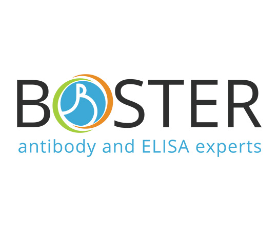 86-4714-80Bovine Neurotrophin-3 ELISA Kit PicoKine 96 wellskit with removable strips. EK0472-BV