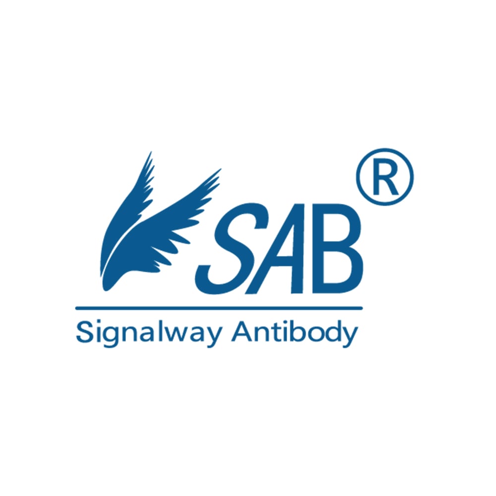 86-7201-97 Recombinant Human NAD-dependent protein deacetylase sirtuin-1（SIRT1） 100ug AP73960