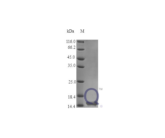89-5345-56 Human TSLP E.coli QP10350-ec-2ug アズワン 通販即納