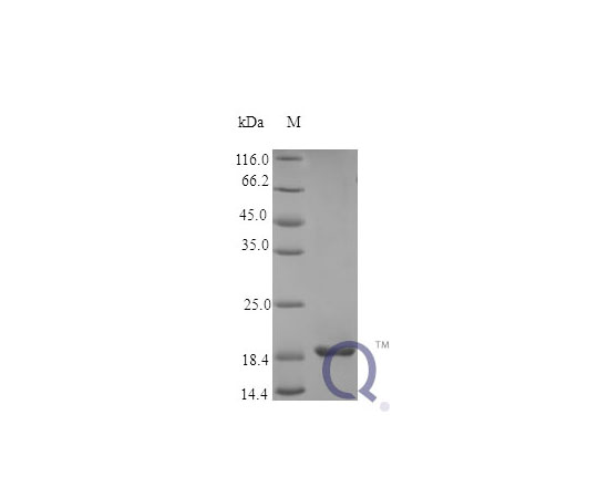 89-5345-60 Human FGF4 E.coli QP10378-ec-5ug アズワン 通販超特価