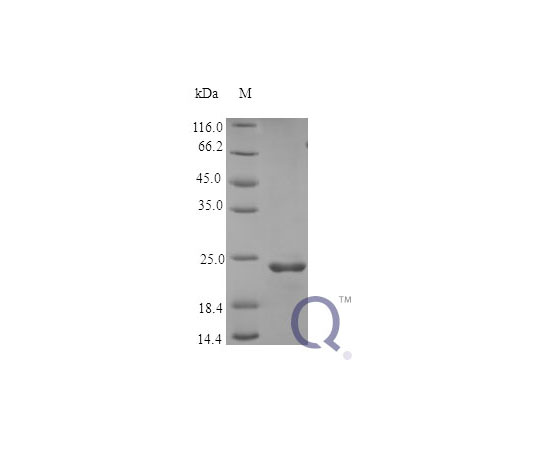 89-5345-62 Human FGF9 E.coli QP10380-ec-5ug アズワン 最安値得価