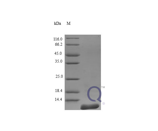 89-5347-33 MCP-2 E.coli QP10231-ec-2ug アズワン Human CCL8 &x2F; 超特価激安