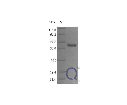 89-5348-77 Human Protein CYR61 E.coli QP10401-ec-5ug アズワン 正規店格安