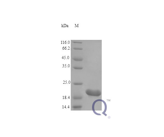 89-5353-13 CTF1 E.coli QP10167-ec-2ug アズワン Rat Cardiotrophin-1 &x2F; 新作最安値