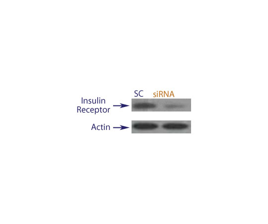 89-5630-73 Human Insulin Receptor siRNA Translation BlockerTM Duplex QX51-10nmol アズワン 限定10％OFF