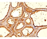 Thyroglobulin （Thyroidal Cell Marker） 100ug