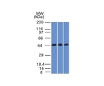 Napsin A （Lung Adenocarcinoma Marker） 100ug