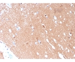 Tubulin beta 3 / TUBB3 （Neuronal ＆ Stem Cell Marker） 100ug