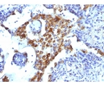 Napsin A （Lung Adenocarcinoma Marker） 100ug
