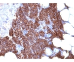 Parathyroid Hormone （PTH） （N- ＆ C-Terminal） 20ug