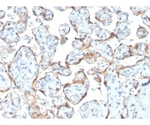 TIMP2 （Tissue Inhibitor of Metalloproteinase 2） 100ug