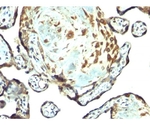 TIMP-3 （Tissue Inhibitor of Metalloproteinase-3） 100ug