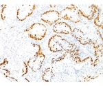 TTF-1 / NKX2.1 （Thyroid ＆ Lung Epithelial Marker） 100ug