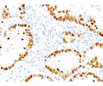 TTF-1 / NKX2.1 （Thyroid ＆ Lung Epithelial Marker） 100ug