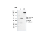 CD284 （Toll-Like Receptor 4） 100ug